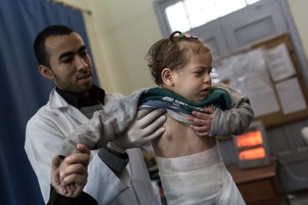 A doctor takes care of a child in an hospital in Gaza 